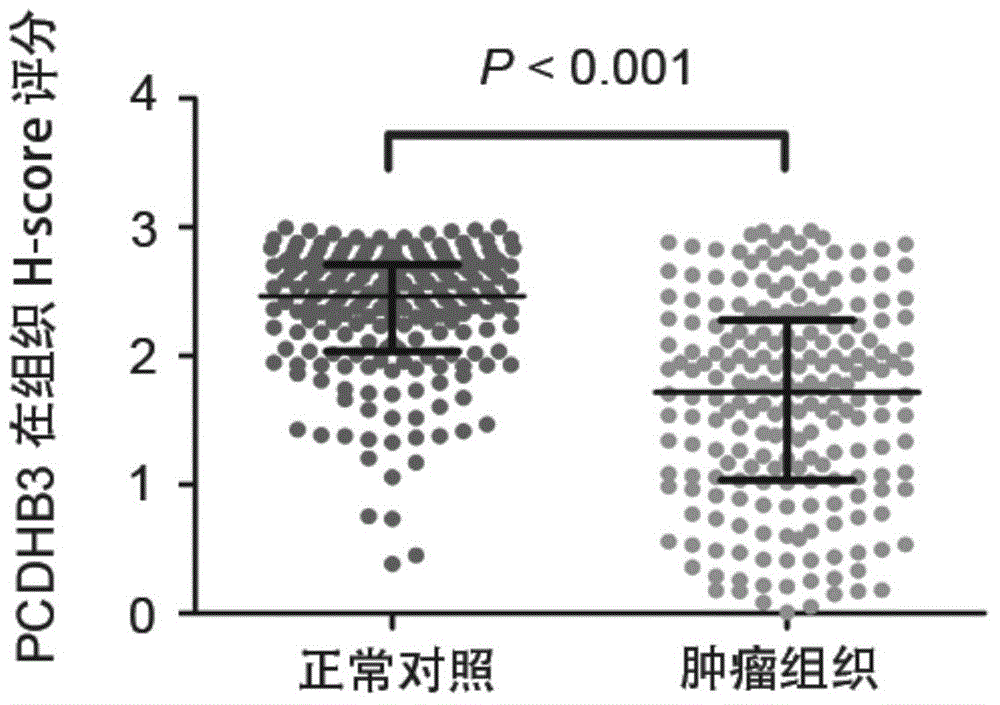 Kit for colorectal cancer auxiliary diagnosis and/or prognosis