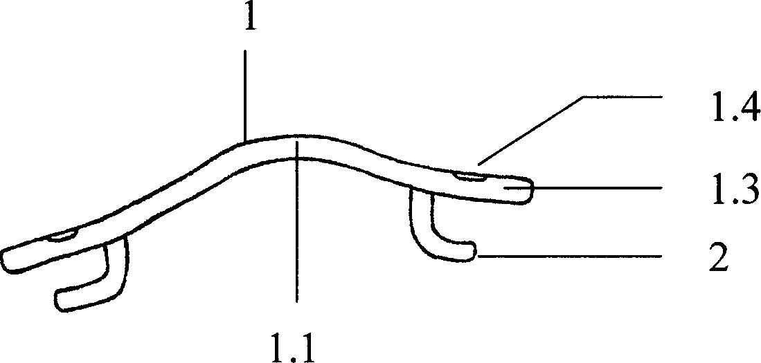 A shape memory fixer for vertebral canal plastic operation