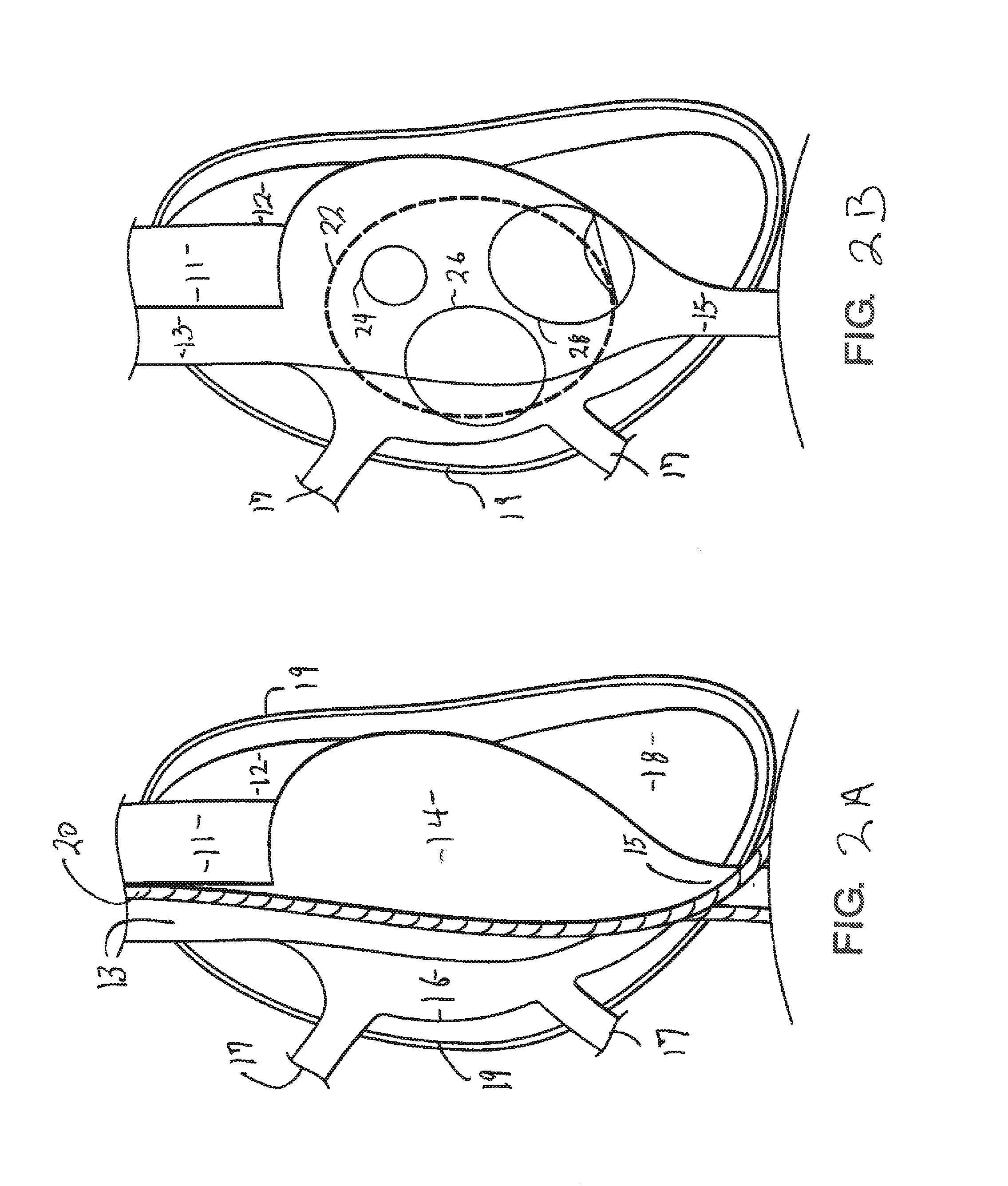 Introductory assembly and method for inserting intracardiac instruments