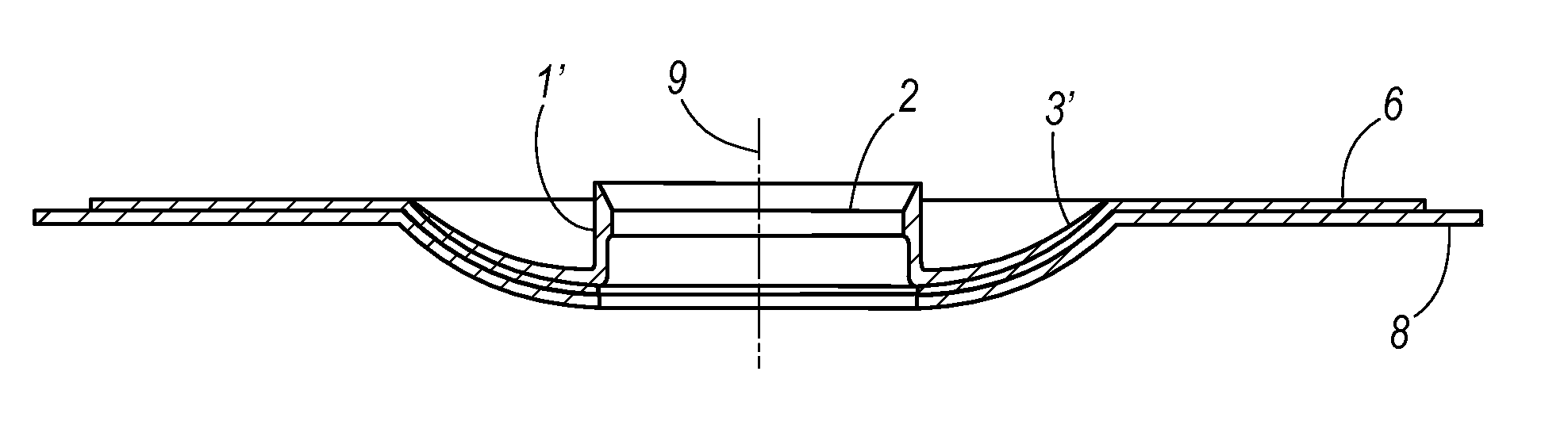 Plaster for tracheostoma valves