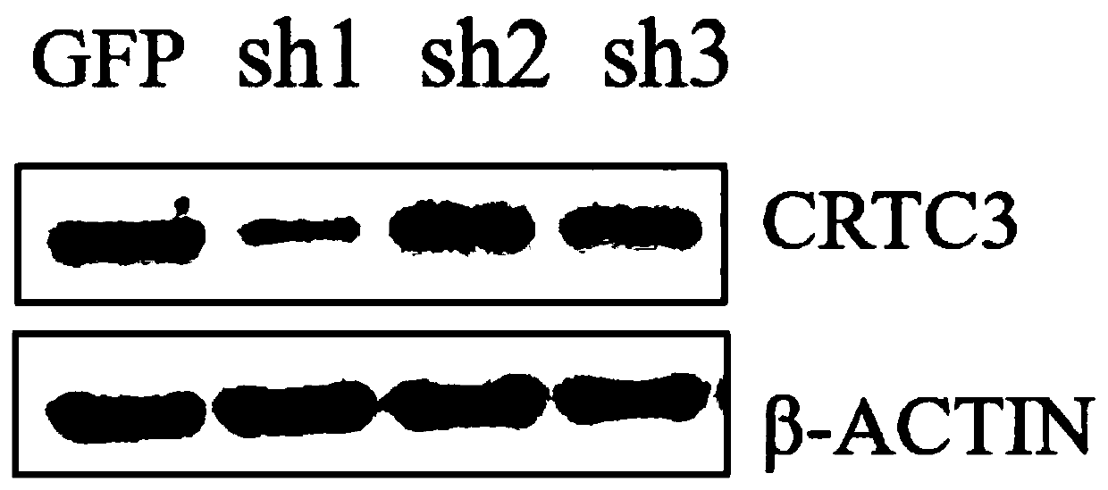 A construction method and application of plasmids for interfering pig CRTC3 gene expression and adenoviruses