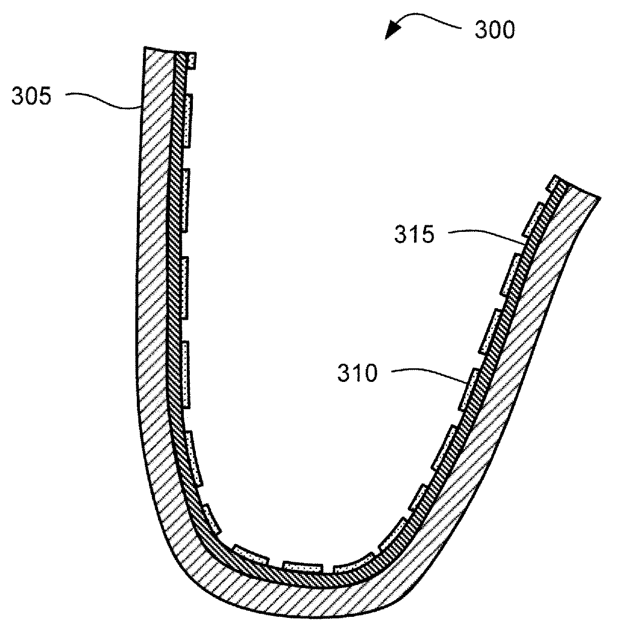 Iontophoresis and Active Dental Appliances