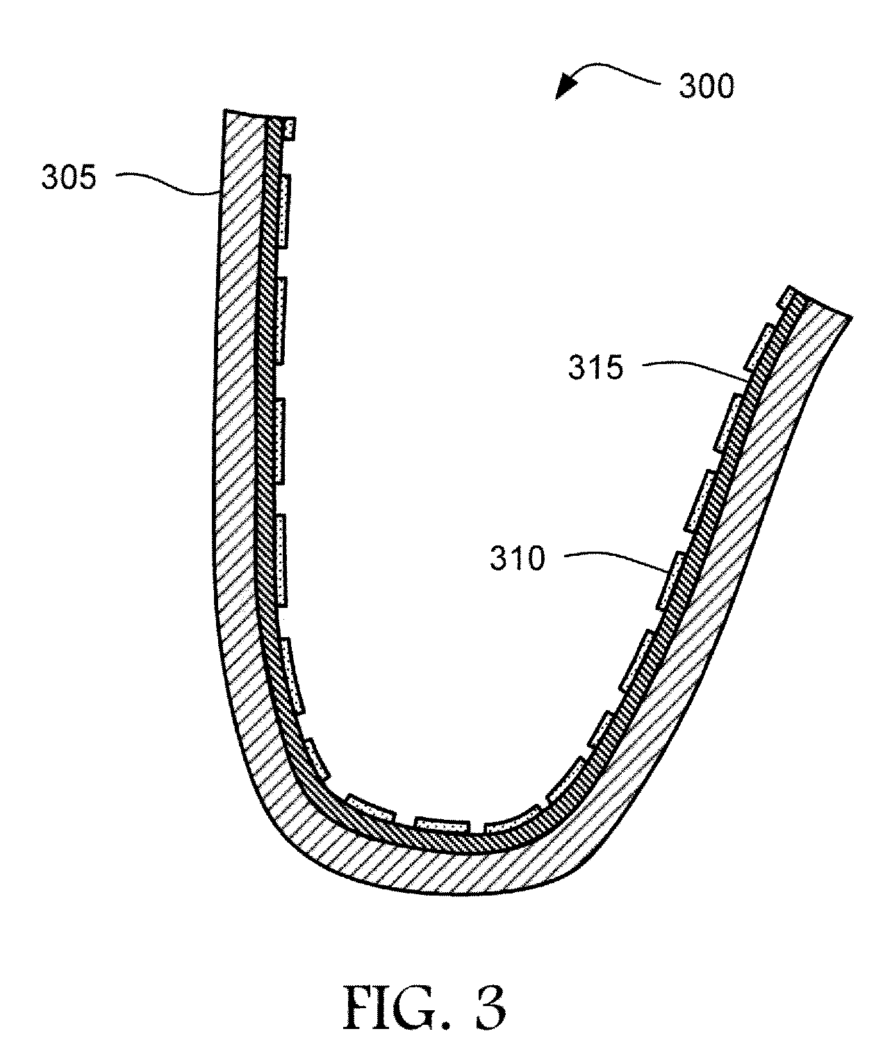 Iontophoresis and Active Dental Appliances