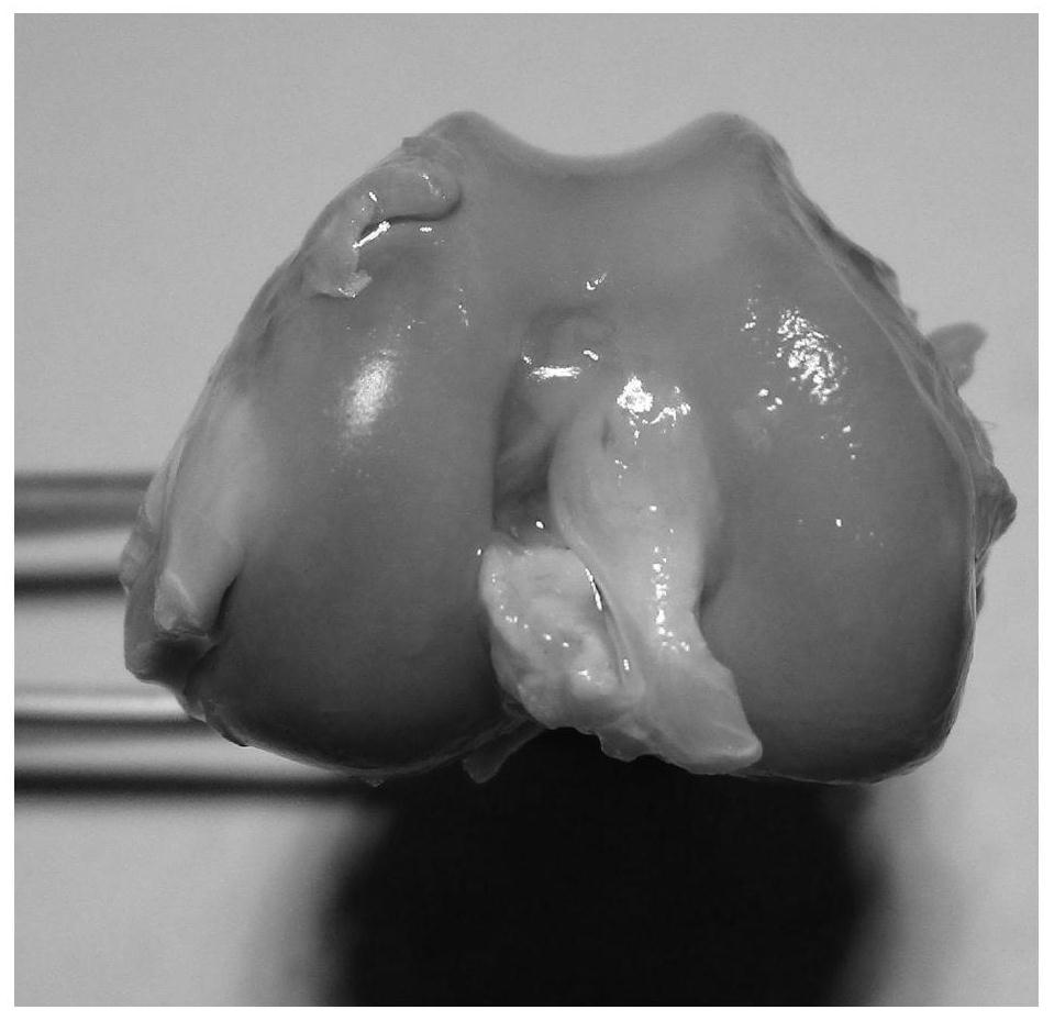 Application of arabinoxylan sulfonate in preparation of medicine for treating osteoarthritis