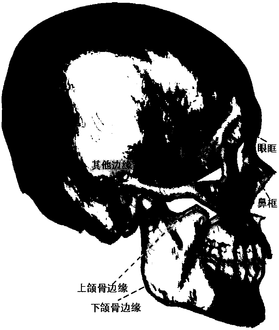 Method and device for automatic registration of three-dimensional skull