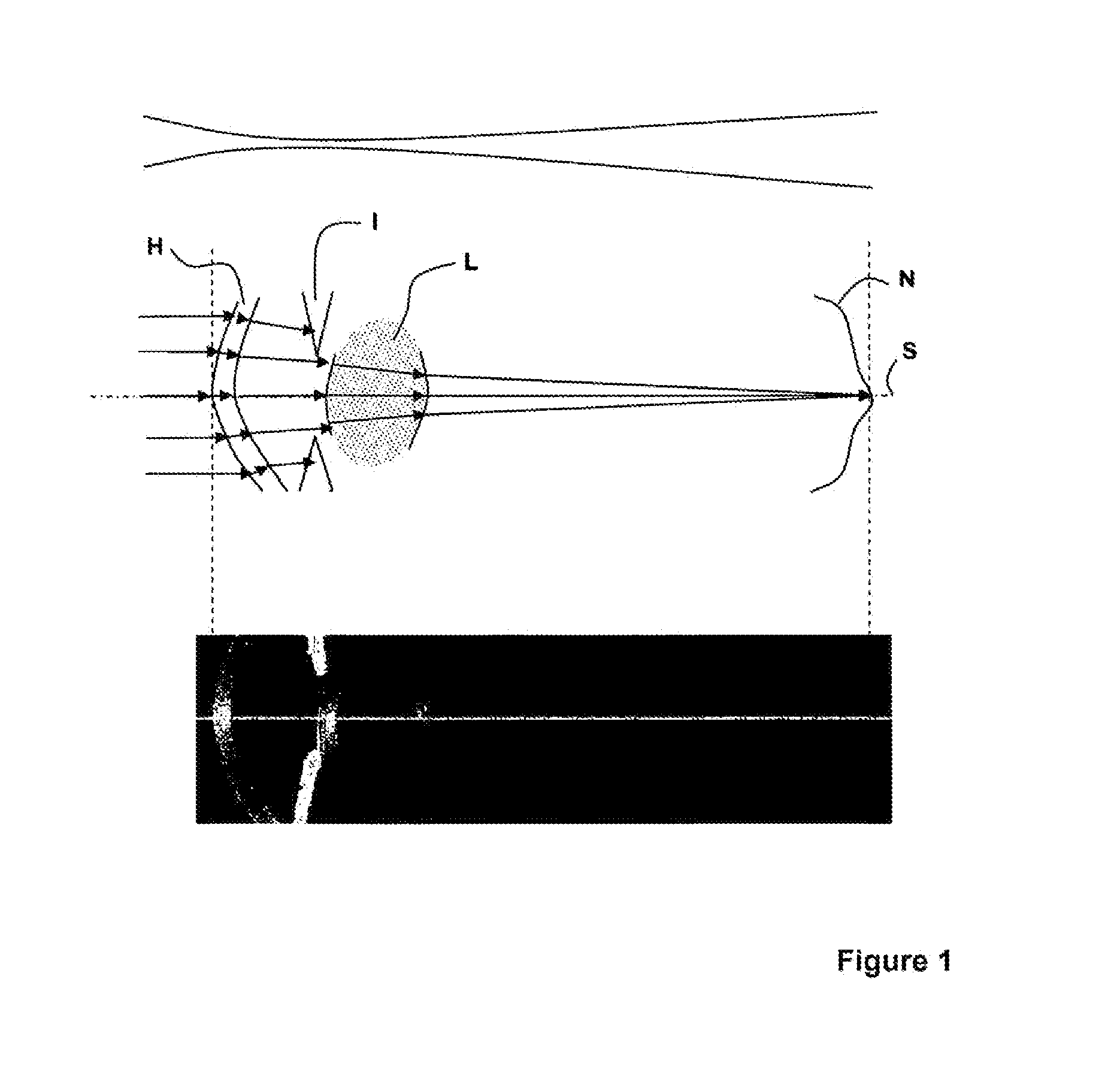 Method and device for recording and displaying an oct whole-eye scan