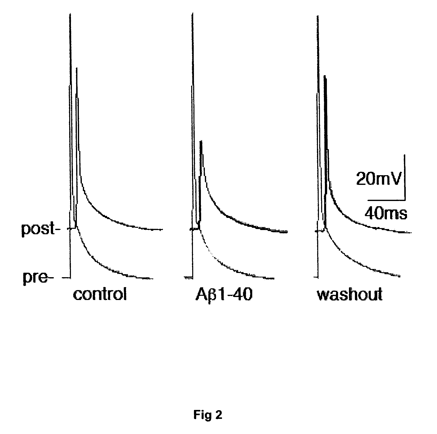 Reversible inhibition of pyramidal gap junction activity