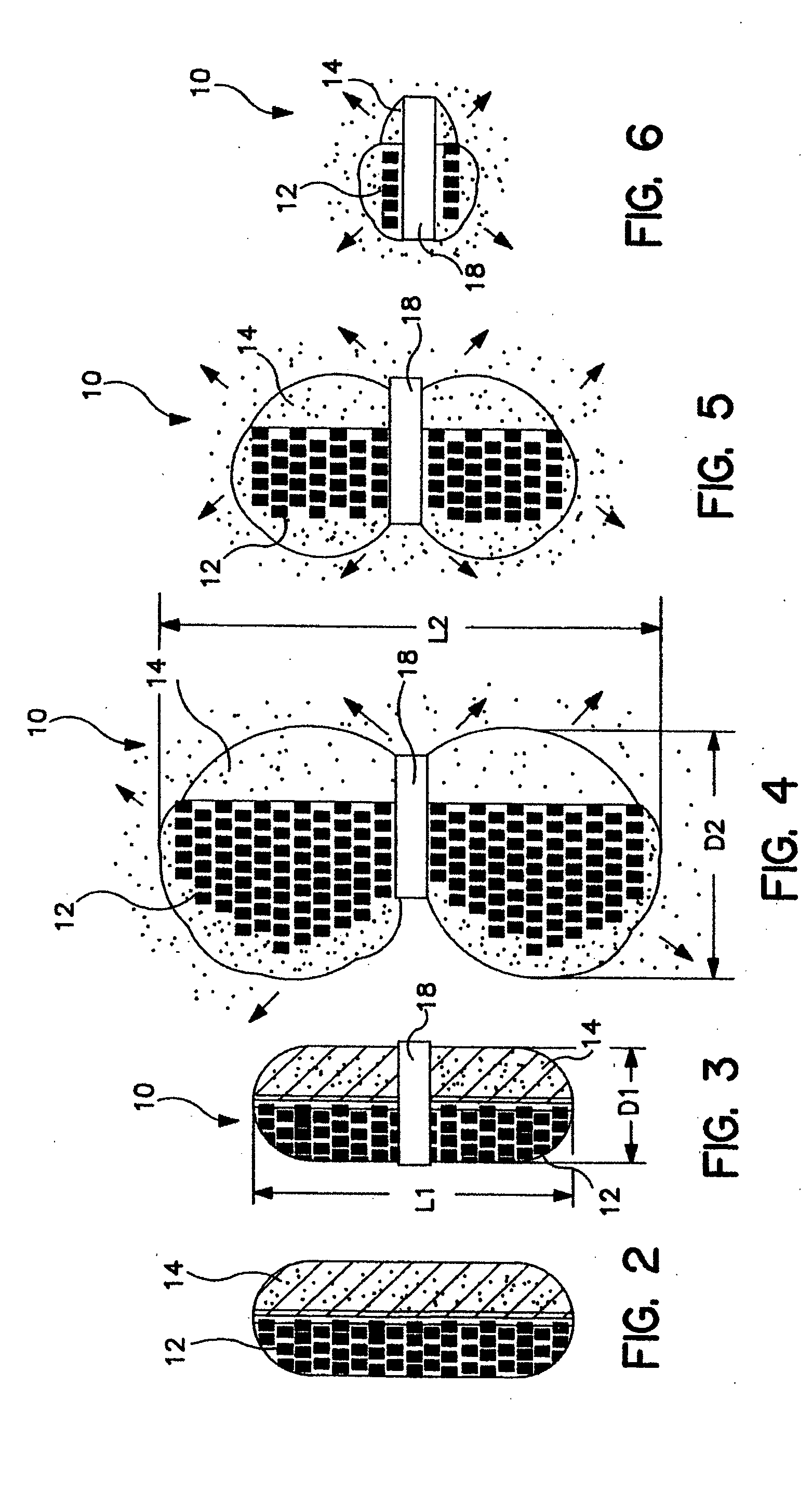 Gastric retention dosage form having multiple layers