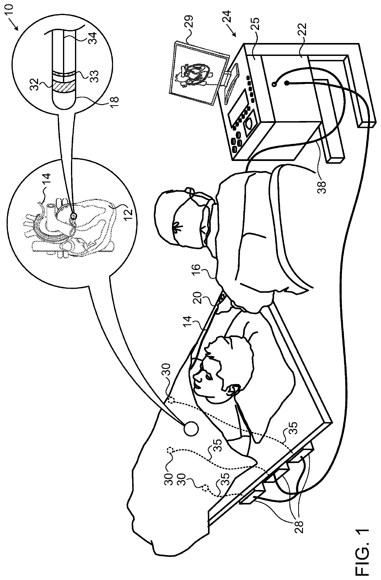 Ablation power control based on contact force