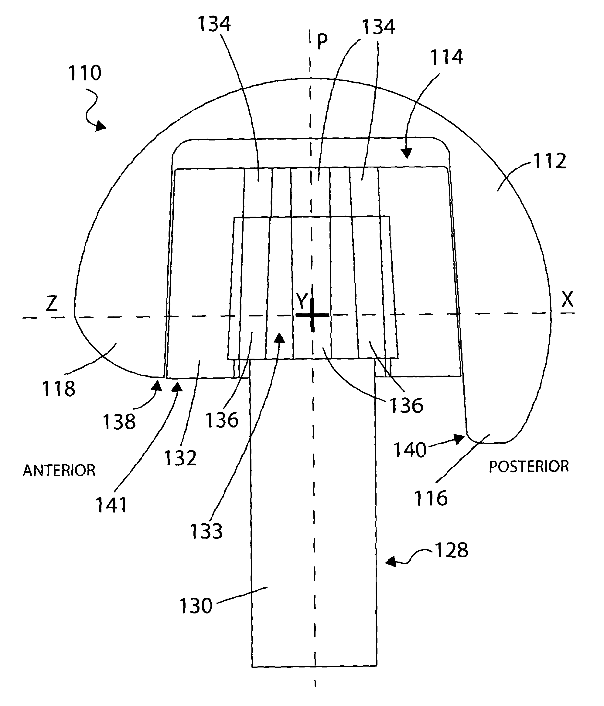 Femoral head prosthesis