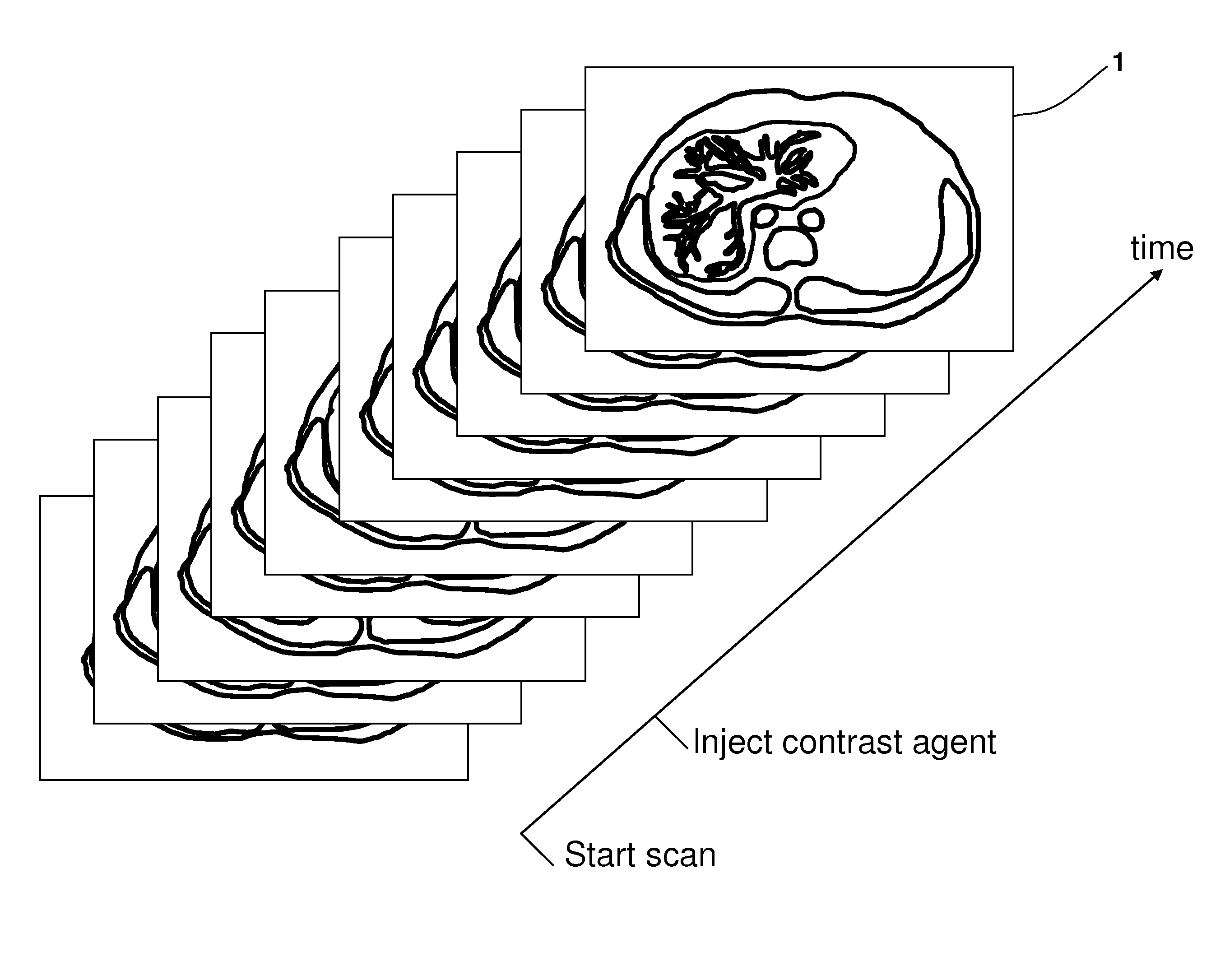 Computer-Based Method And System For Imaging-Based Dynamic Function Evaluation Of An Organ