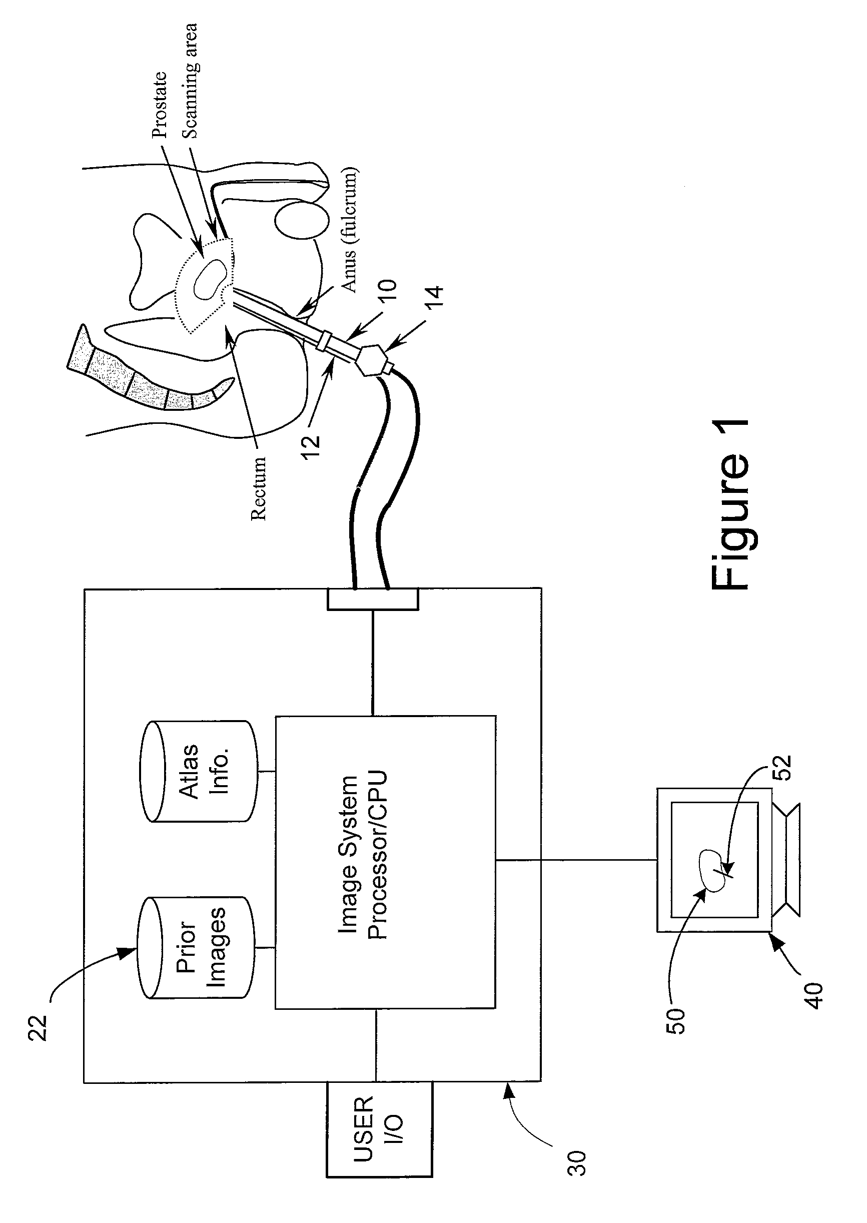 System and method for prostate biopsy