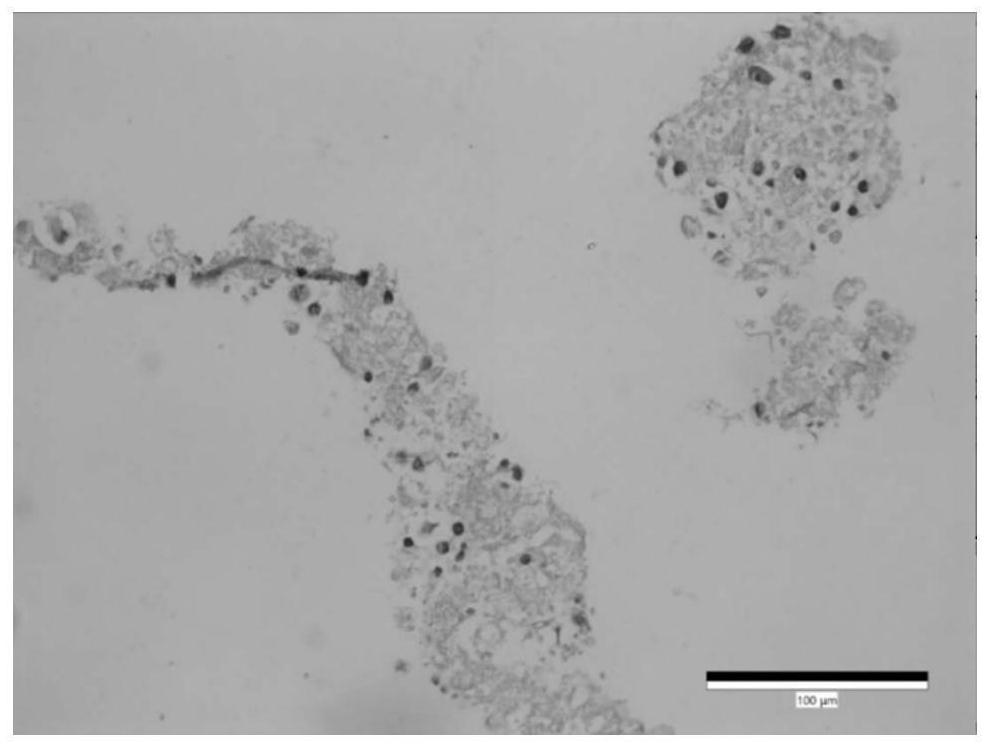 3D culture medium for brain glioma organs and application thereof