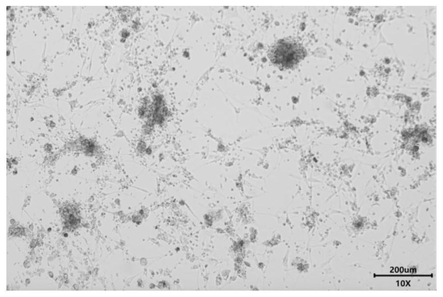 3D culture medium for brain glioma organs and application thereof