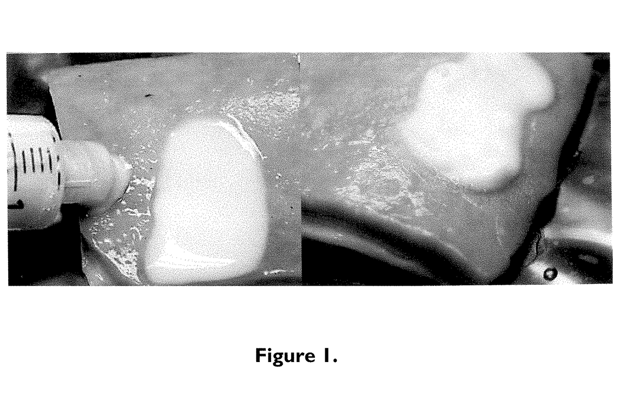 Bimodal treatment methods and compositions for gastrointestinal lesions with active bleeding