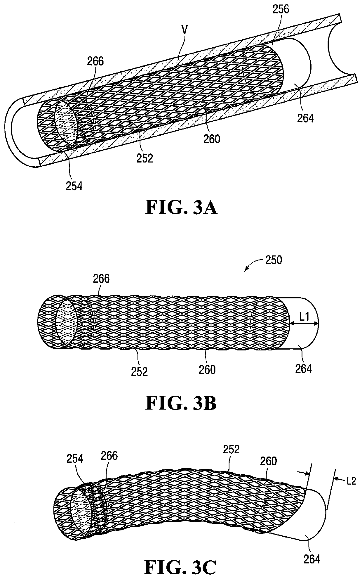 Caped stent