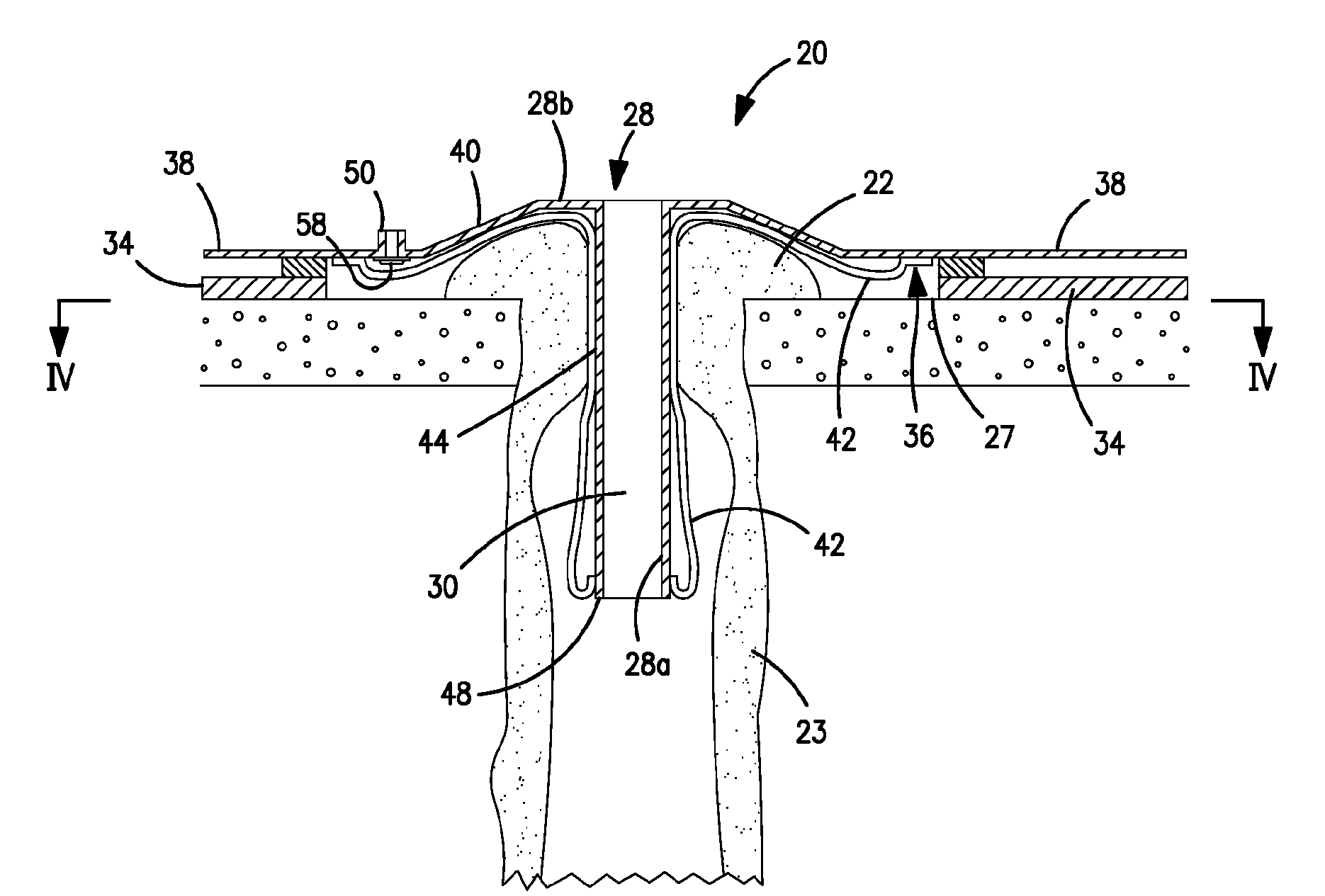 Seal for an ostomy appliance