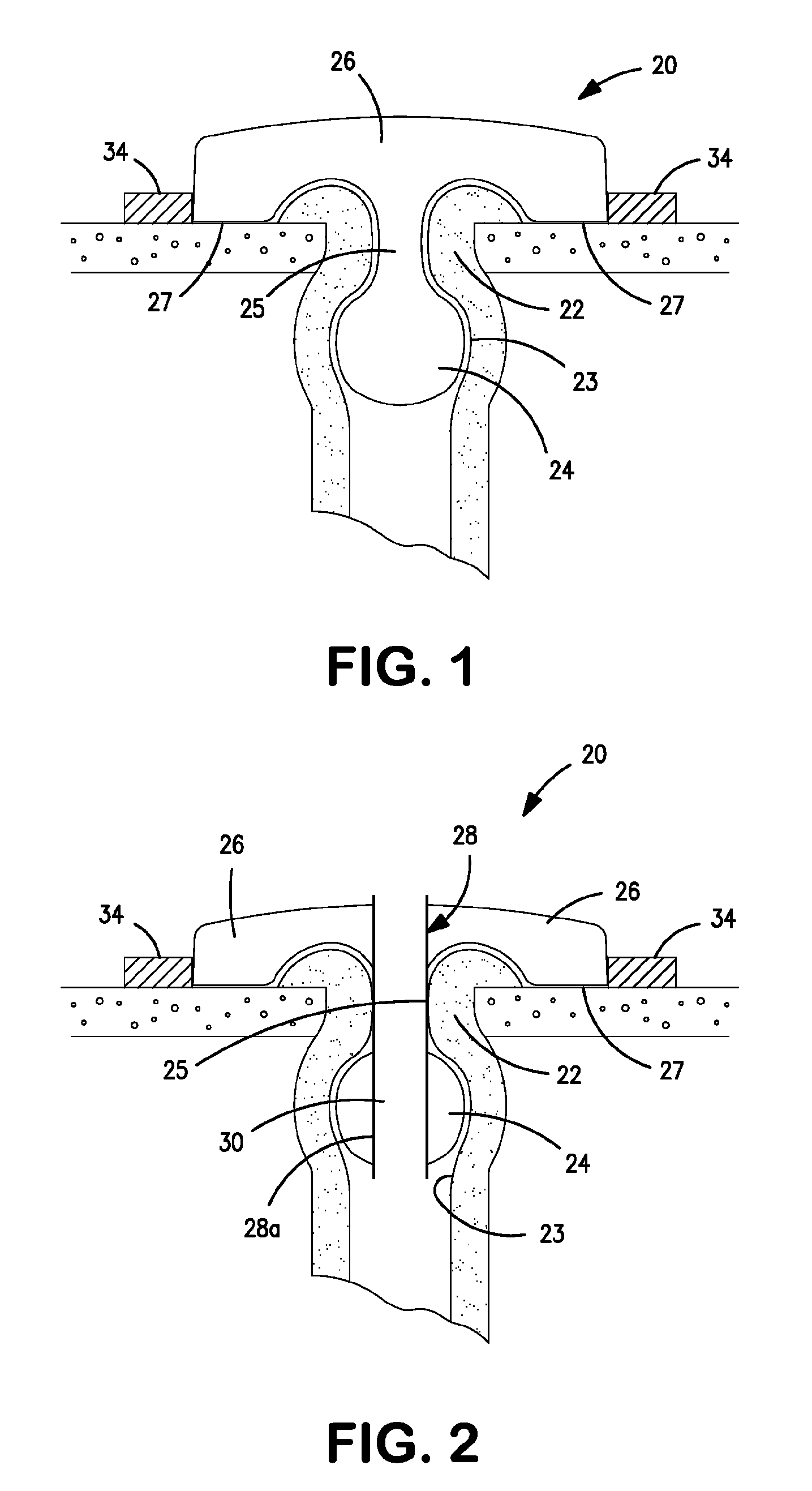 Seal for an ostomy appliance