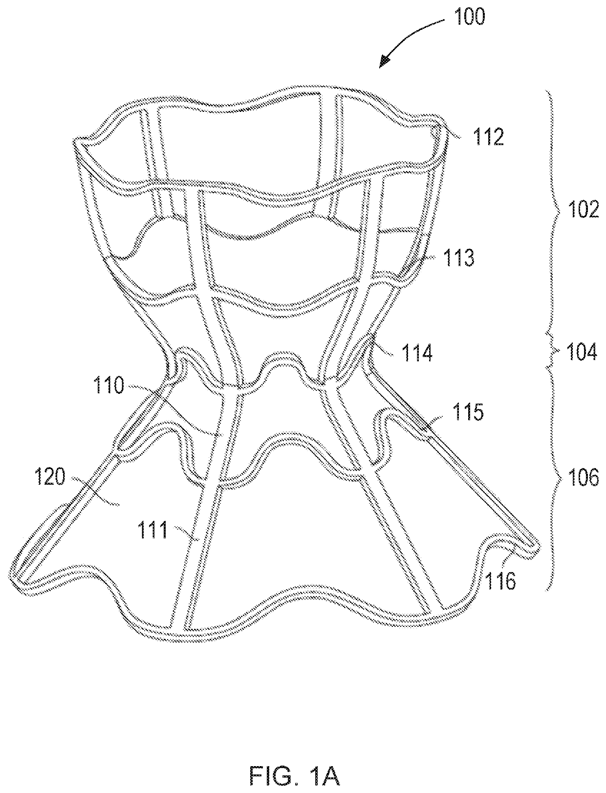 Interatrial shunts having biodegradable material, and methods of making and using same