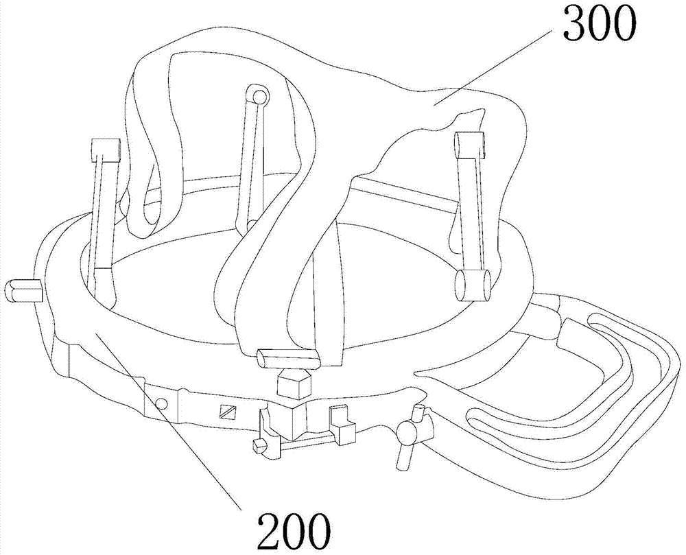 Individualized Stereotaxic Headband Placement Bracket