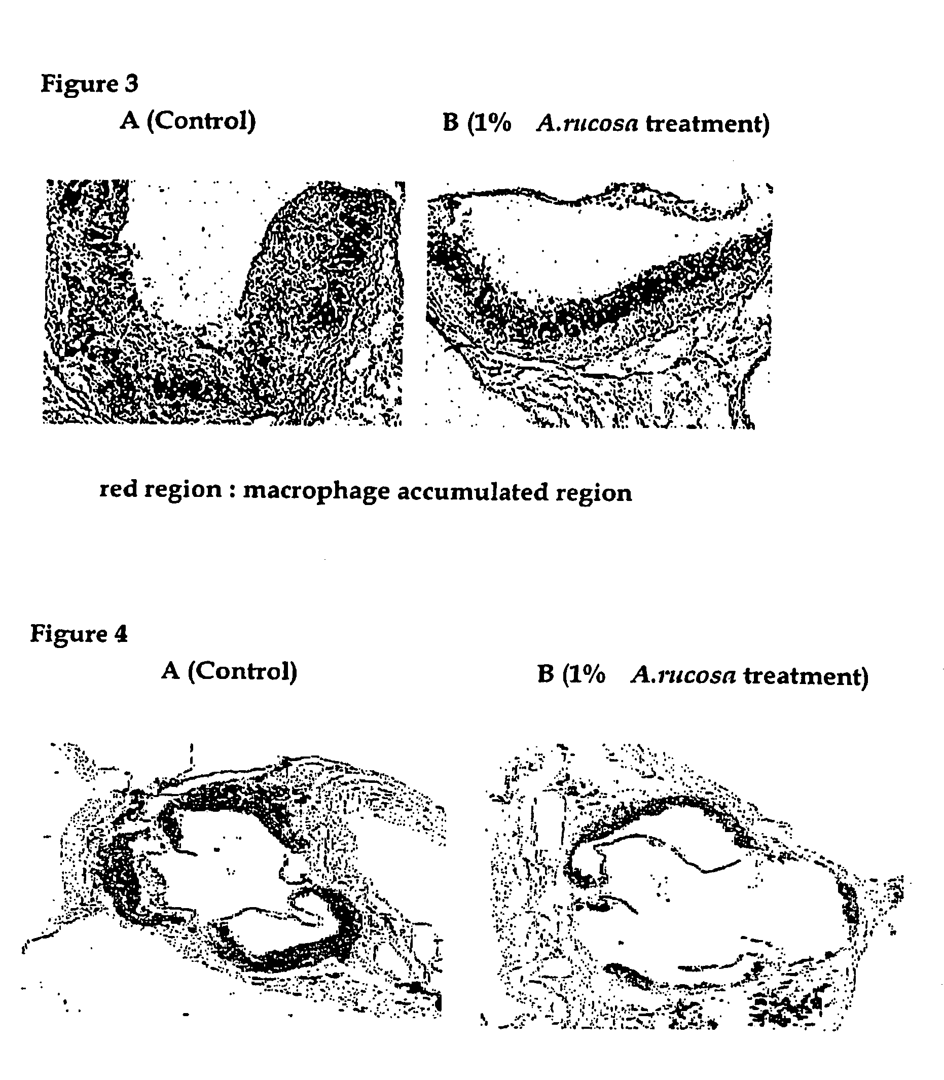 Agastache rugosa extract and composition containing tilianin isolated and purified from said extract having anti-inflammatory activity and anti-atherogenic activity