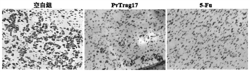 A kind of anti-tumor protein and its application