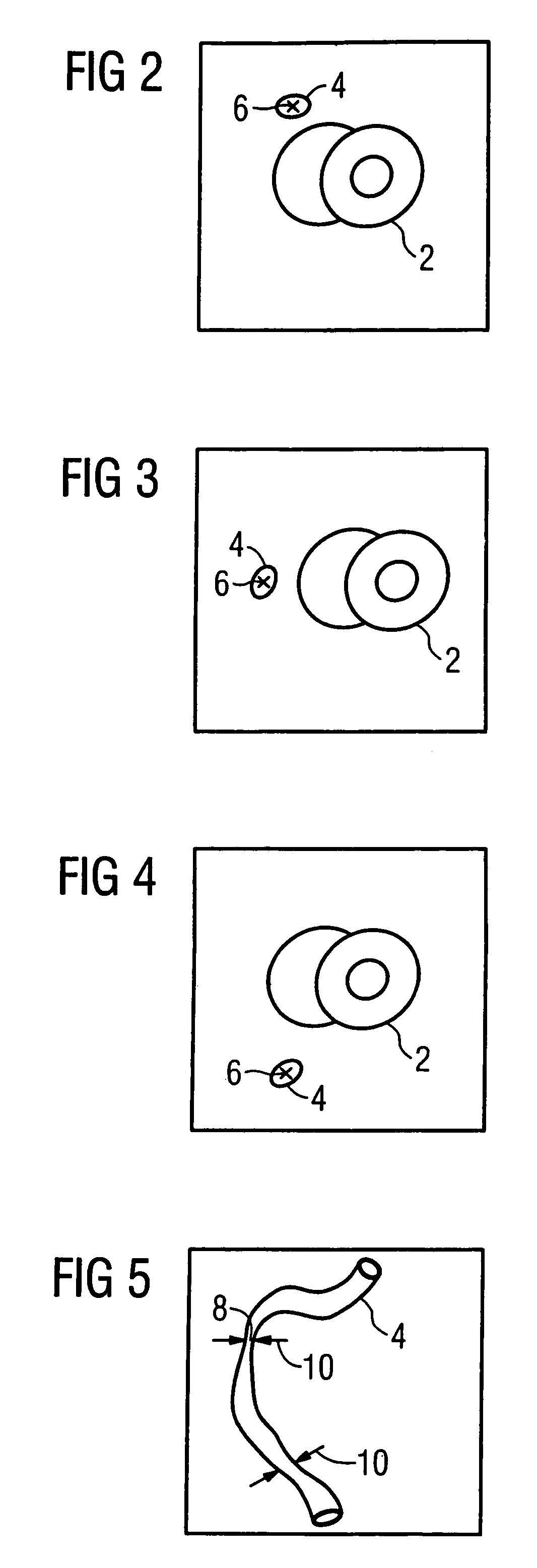 Method for segmenting a medical data set