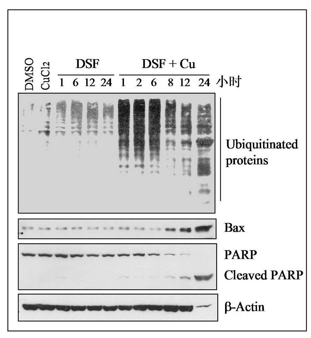 Anticancer composition and its application