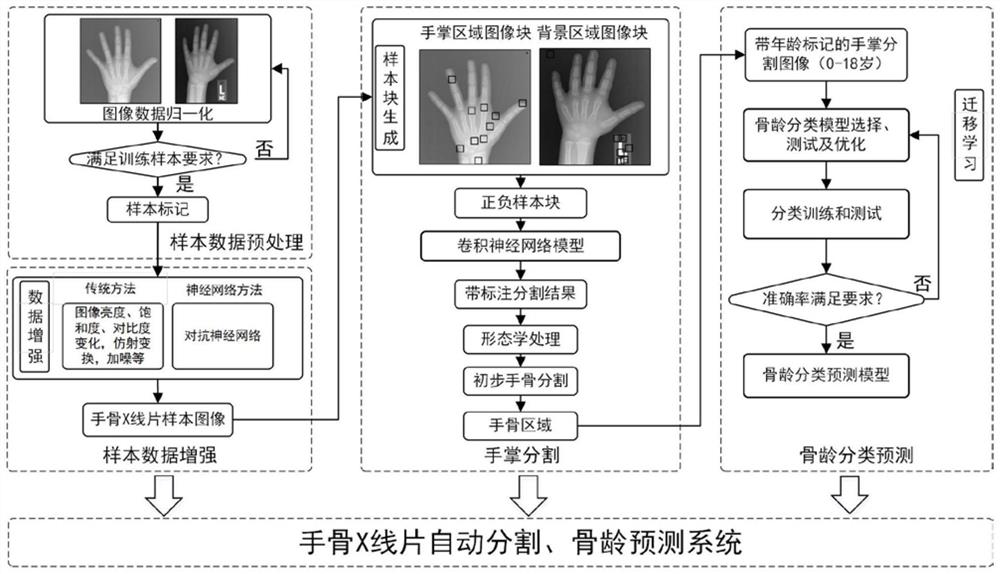 X-ray bone age prediction method and system based on deep learning