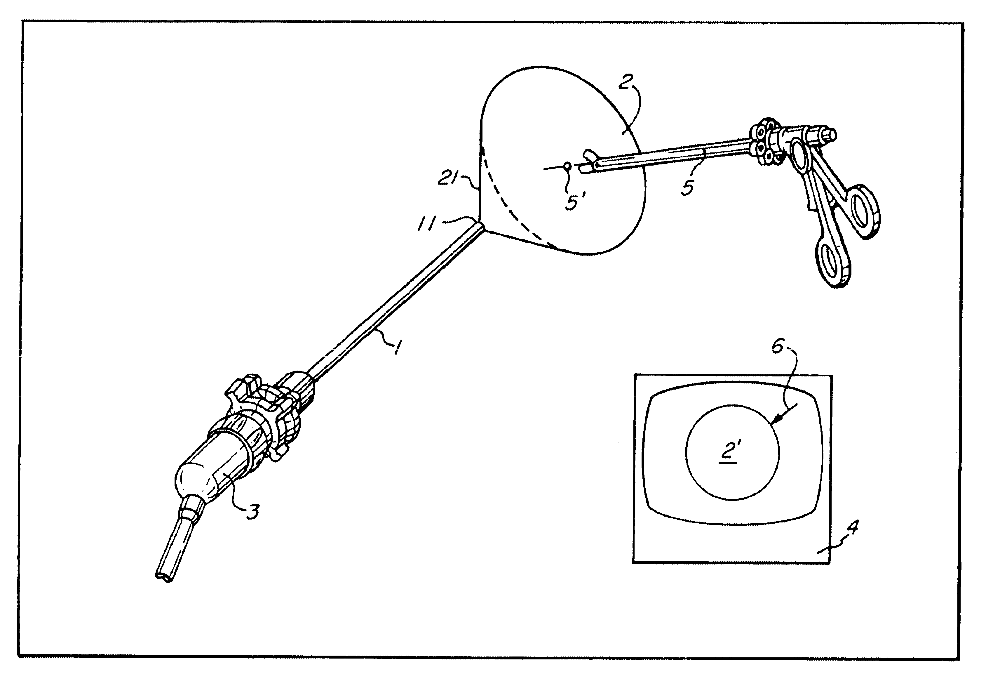 Endoscopic system