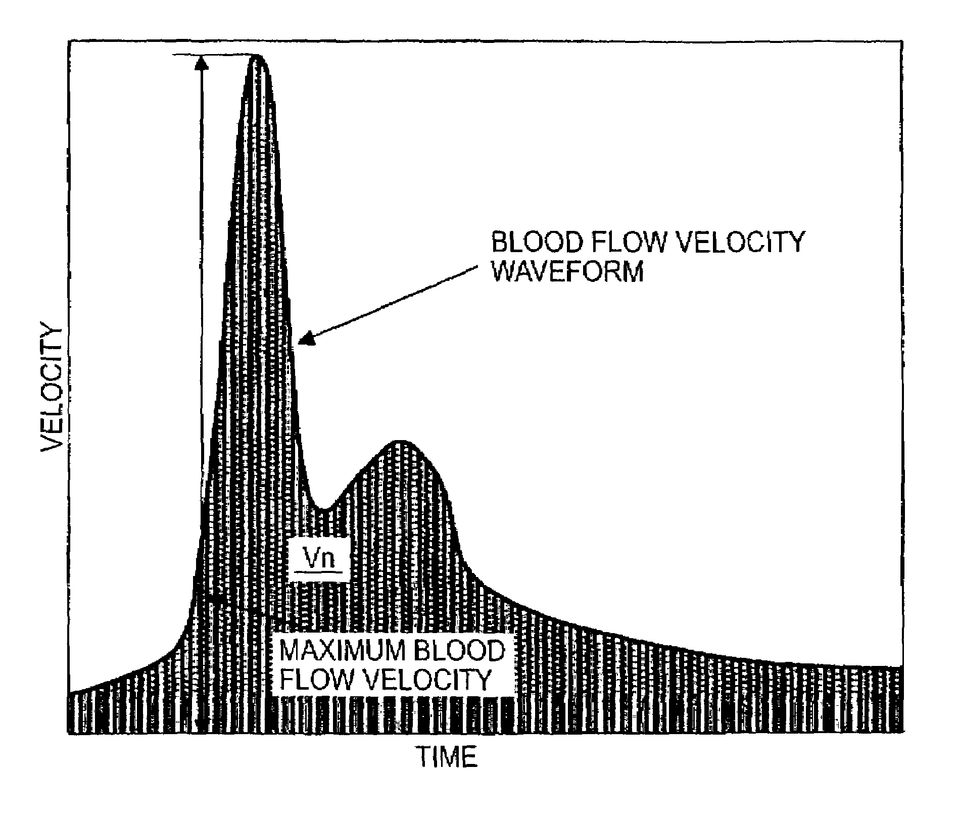 Blood rheology measuring apparatus