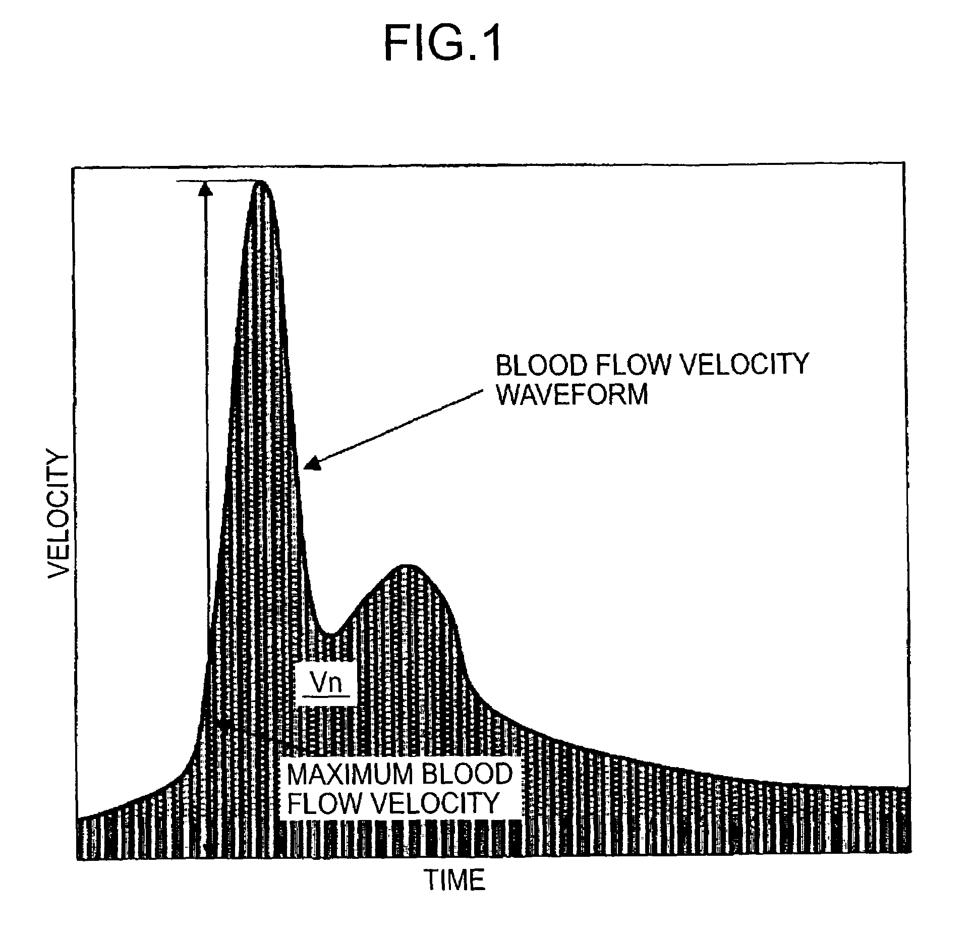 Blood rheology measuring apparatus