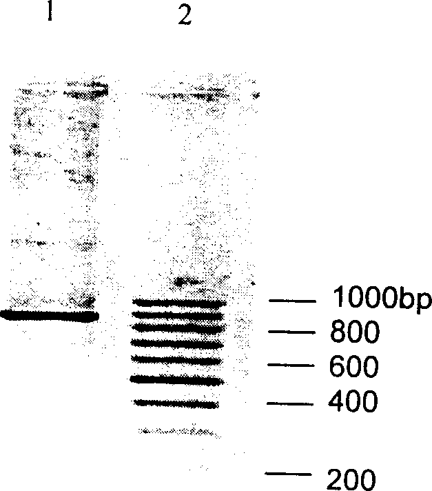 Human ICAM-1 extramembranous I-III domain gene expression product ,its prep. and application in radioimmunological technology