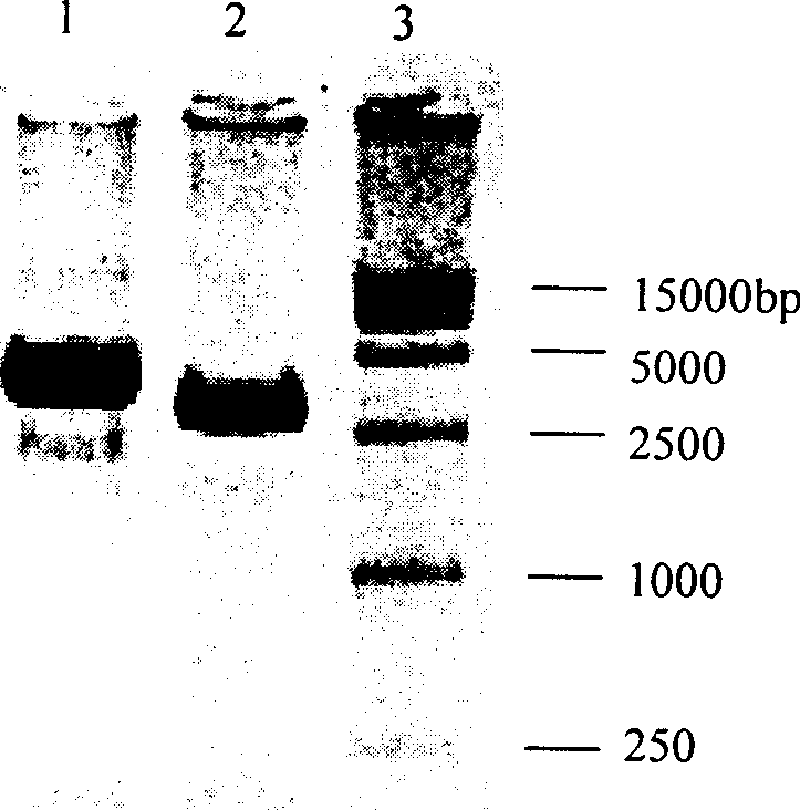 Human ICAM-1 extramembranous I-III domain gene expression product ,its prep. and application in radioimmunological technology