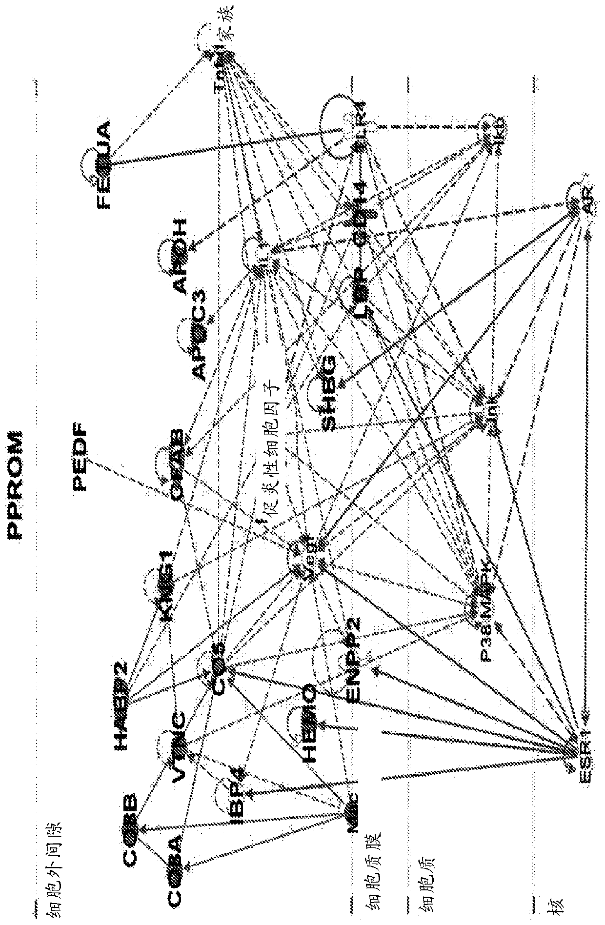 Biomarkers for predicting preterm birth due to preterm premature rupture of membranes versus idiopathic spontaneous labor