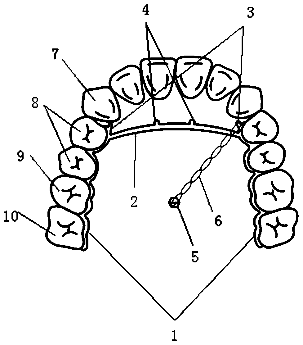 One-piece molar-back-pushing device