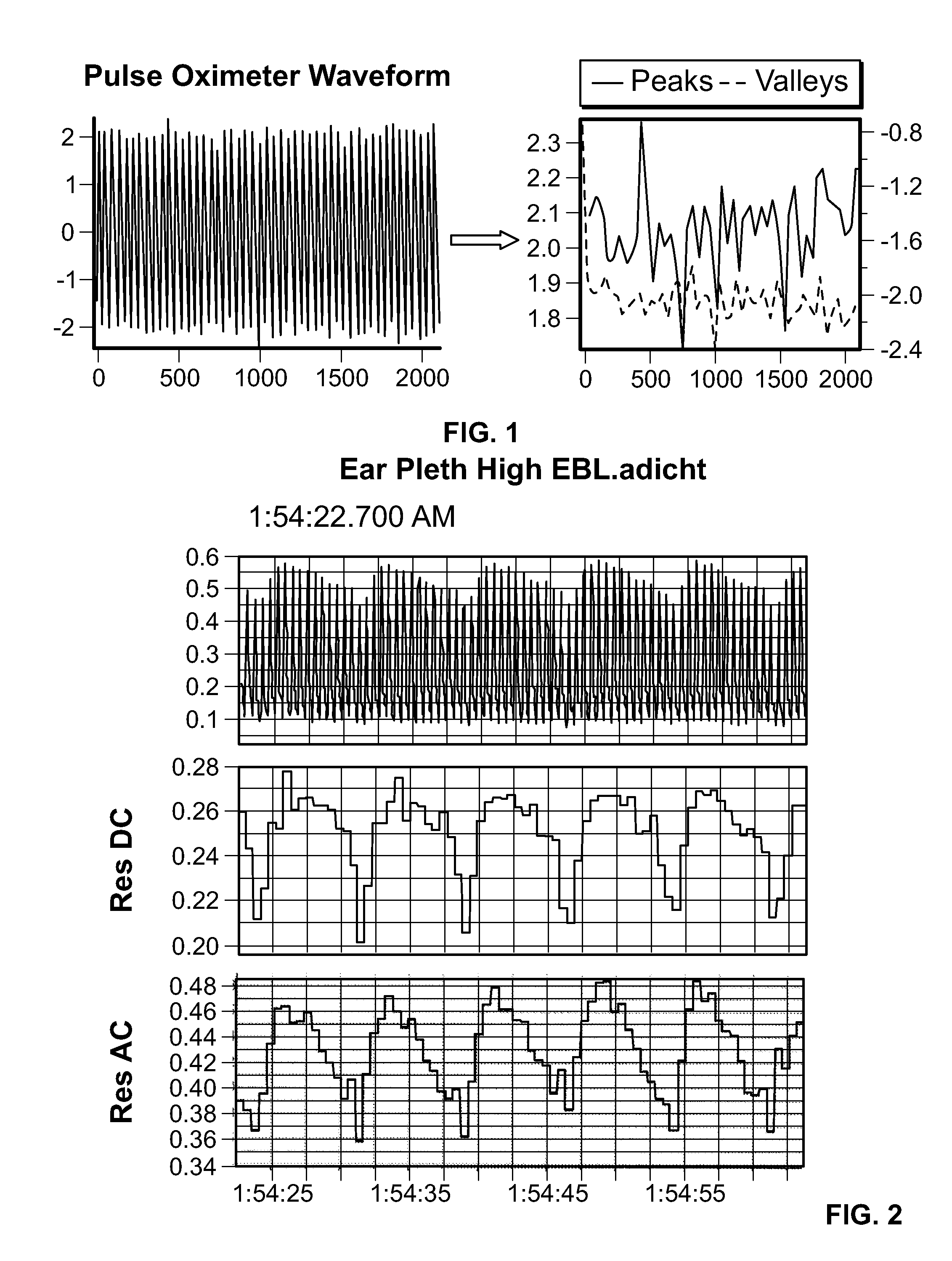 Systems and Methods Utilizing Plethysmographic Data for Distinguishing Arterial and Venous Oxygen Saturations