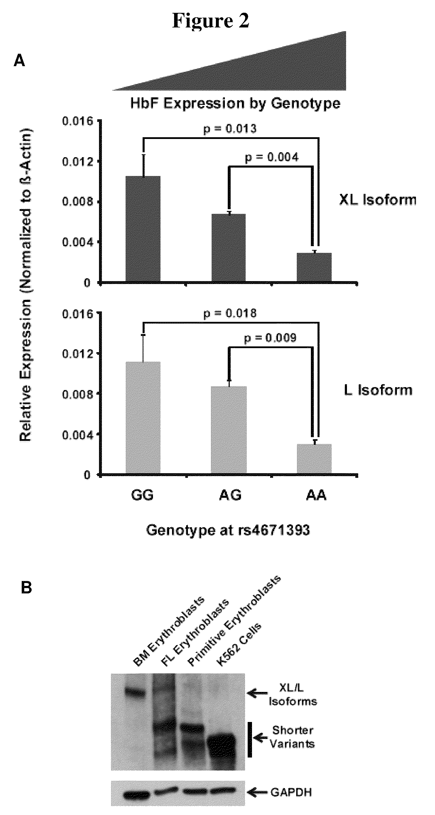 Modulation of BCL11A for treatment of hemoglobinopathies