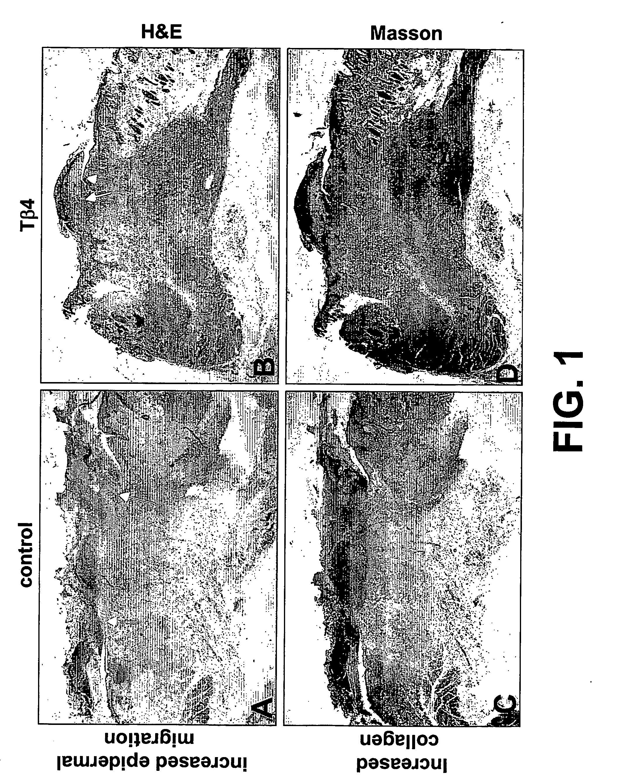 Methods and compositions for the promotion of hair growth utilizing actin binding peptides