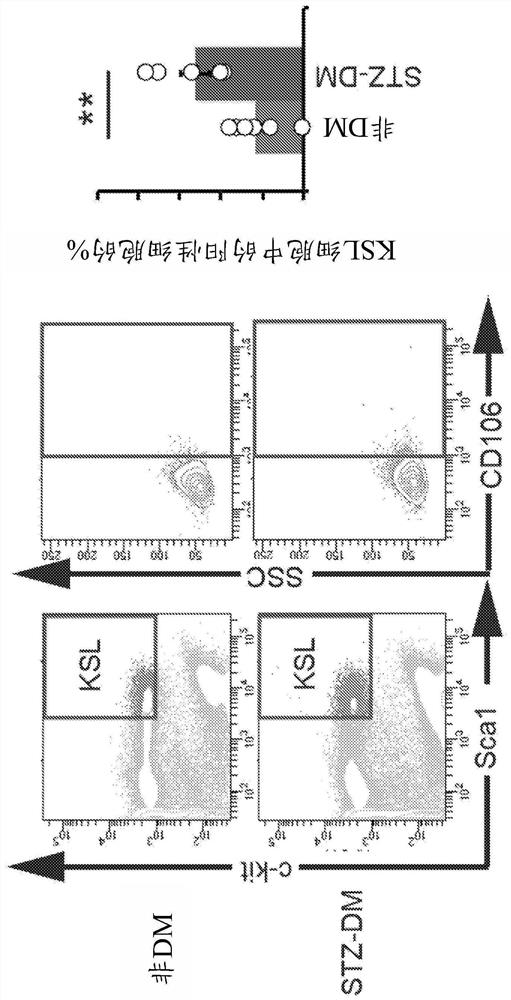 Diabetes treatment targeting abnormal stem cells