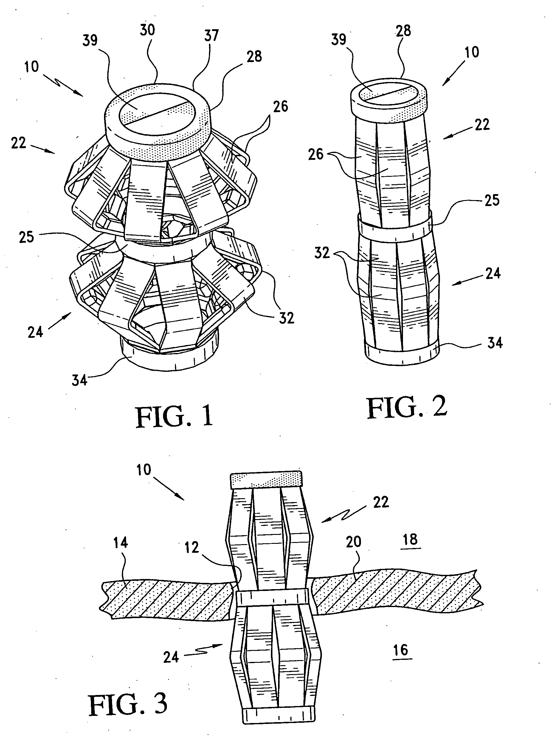 Method and apparatus for sealing a gastric opening