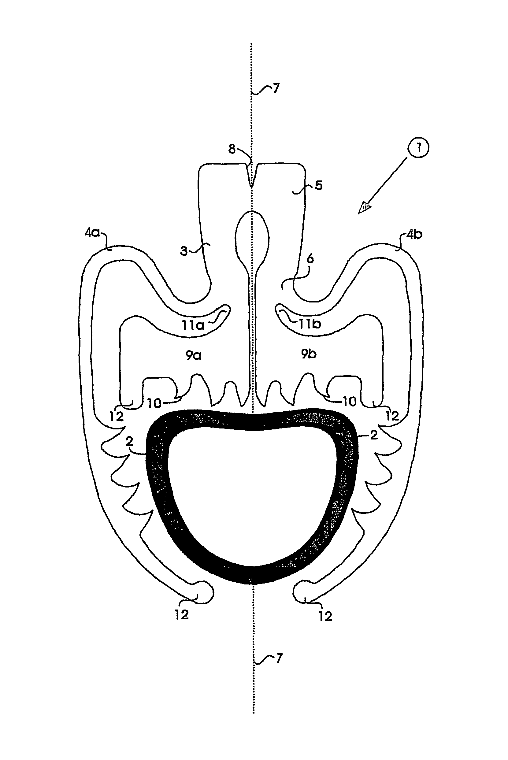 Surgical clip