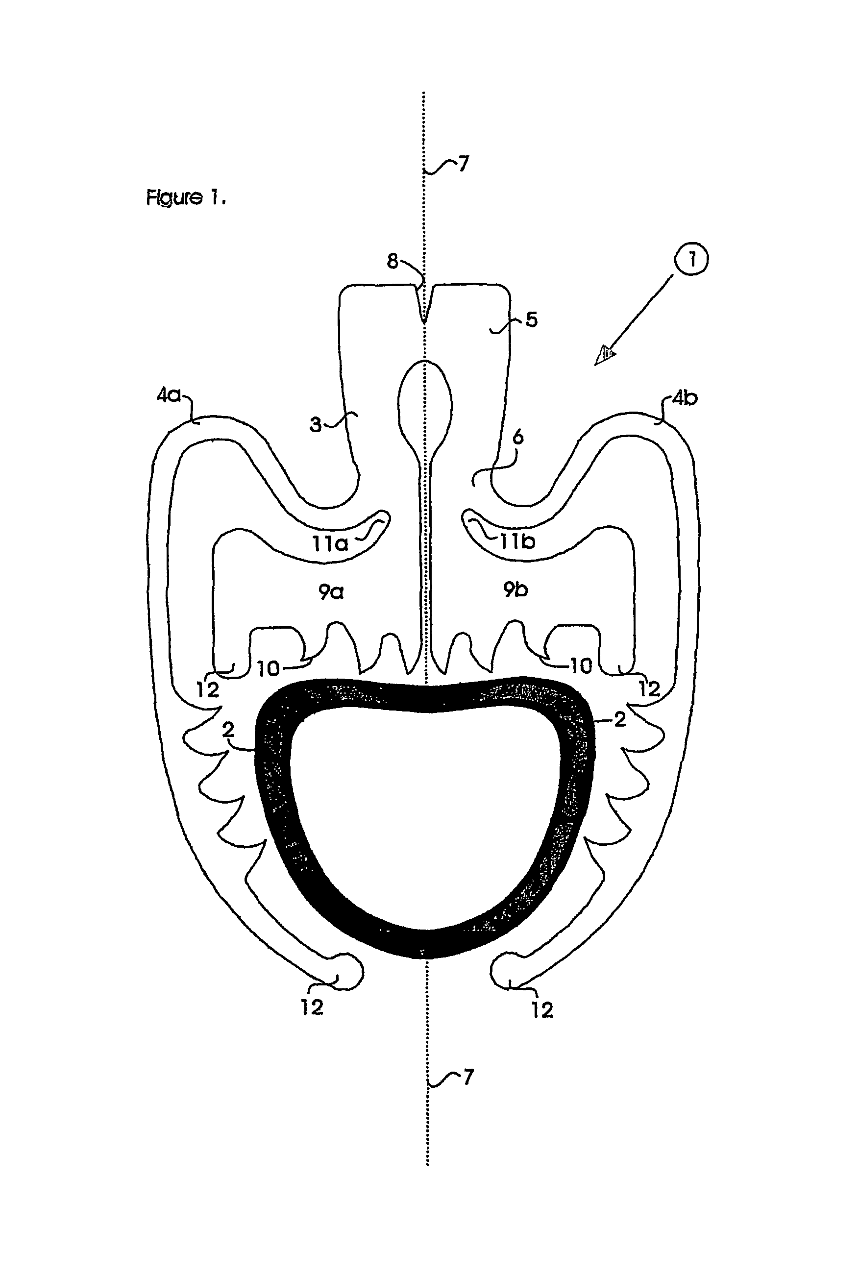 Surgical clip