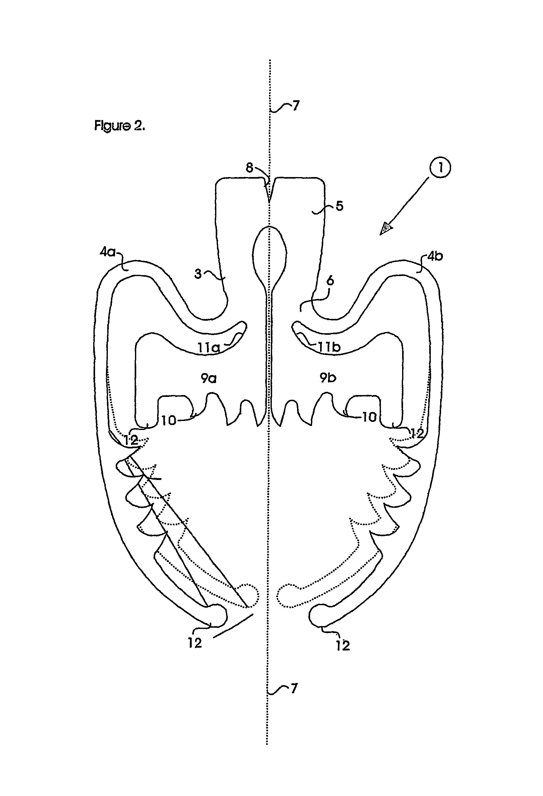 Surgical clip