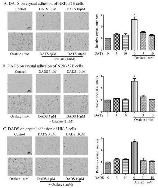 Application of allicin and its derivatives in the preparation of medicines for preventing and treating kidney damage caused by urinary stones and crystals