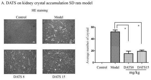 Application of allicin and its derivatives in the preparation of medicines for preventing and treating kidney damage caused by urinary stones and crystals