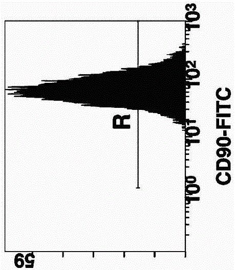 Method for culturing autologous umbilical cord mesenchymal stem cells with platelet-rich lysate from human umbilical cord blood