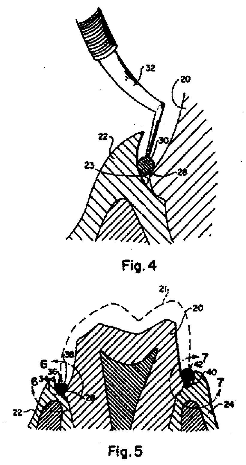 Gingival retraction cord with wetting agent