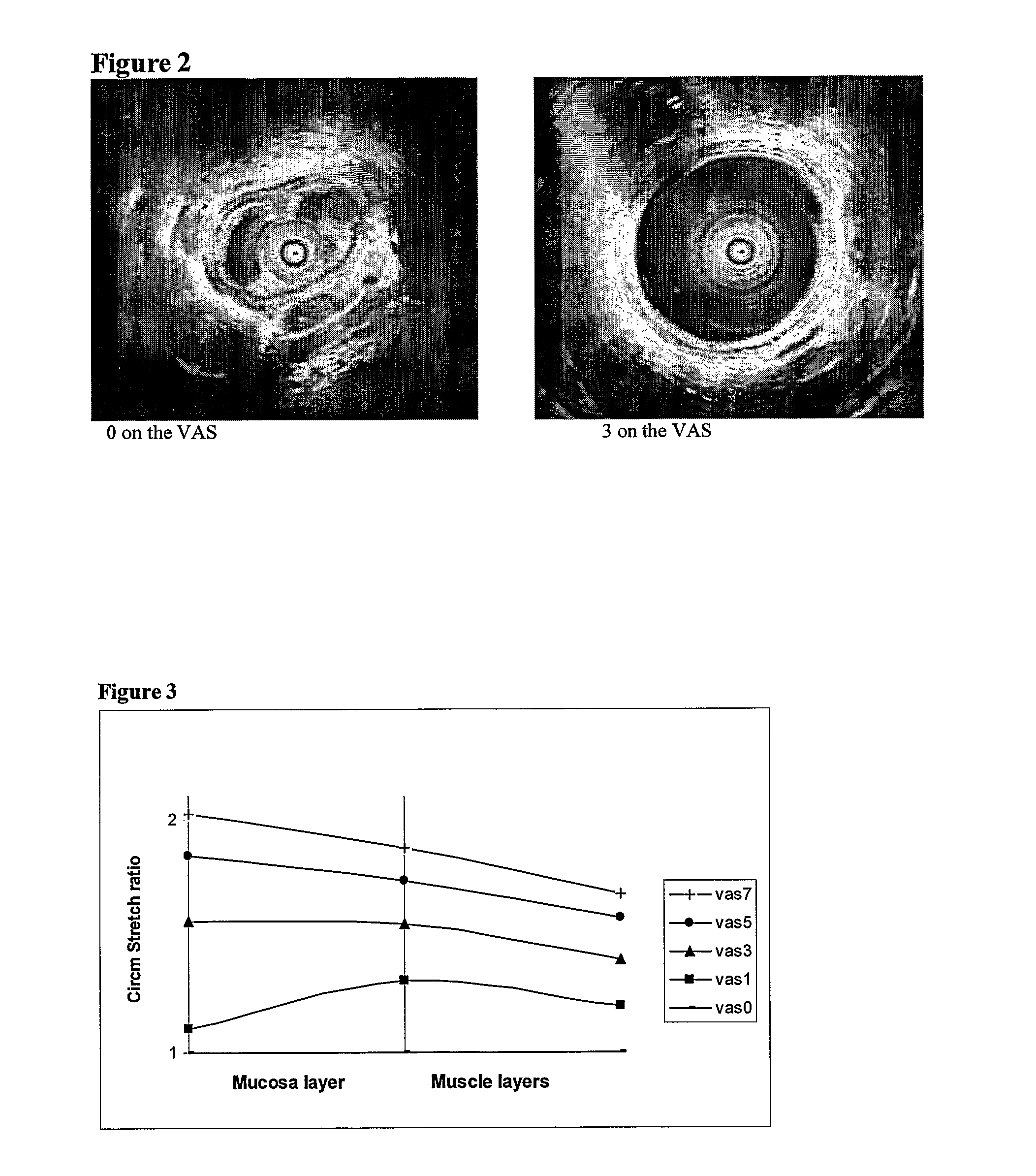 Morphometry of a Bodily Hollow System