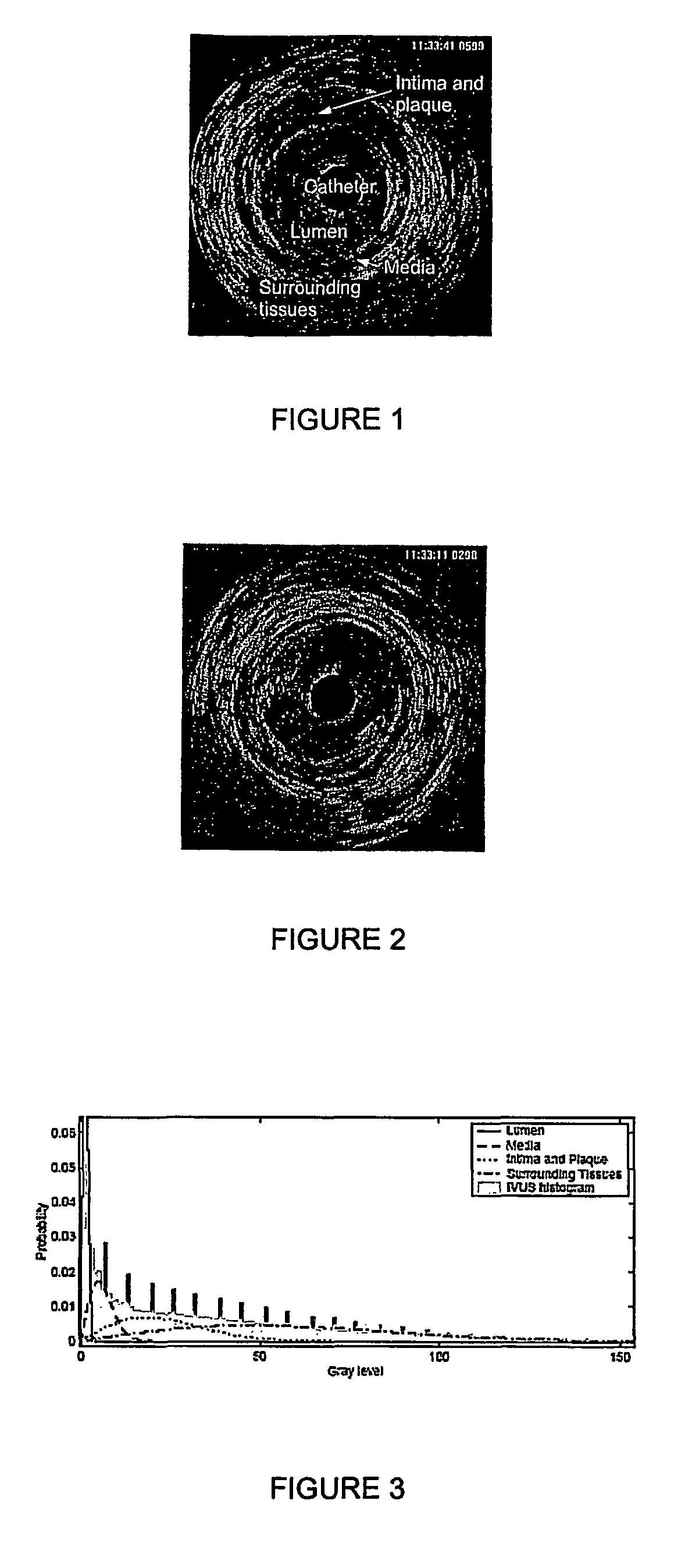 Automatic multi-dimensional intravascular ultrasound image segmentation method